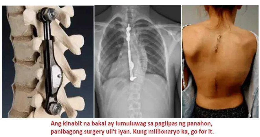 Bakal sa likod.jpg