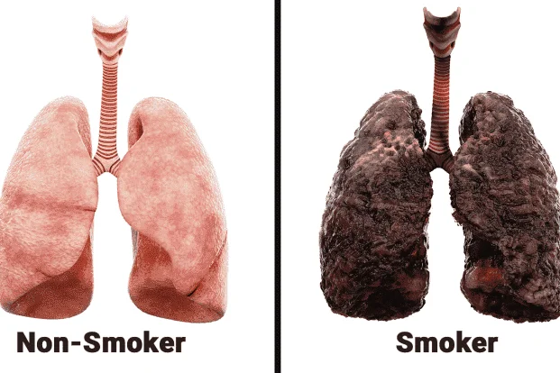 Scientists-Explain-What-*******-Every-Day-Does-To-Your-Lungs.webp