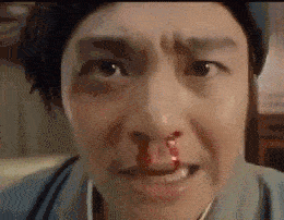 nosebleed-wipe.gif