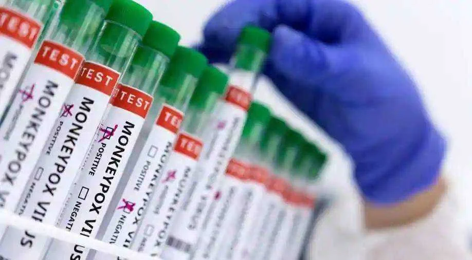 Monkeypox a pandemic, declares World Health Network