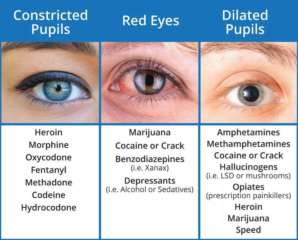 Pupil-Dialation-Drug-Chart.webp