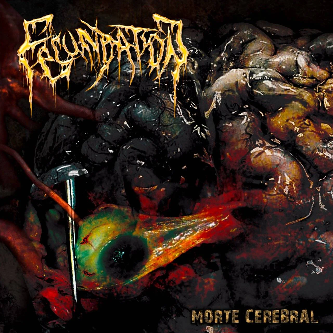 (Korea TechBDM/BDM) Fecundation - [ 2019 ] - Morte Cerebral [ FLAC (Tracks) 16-Bit 44.1 kHz ]