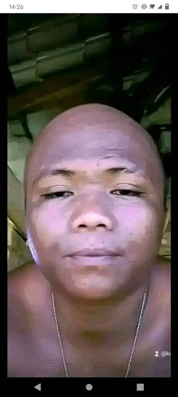 kalbong niga.webp
