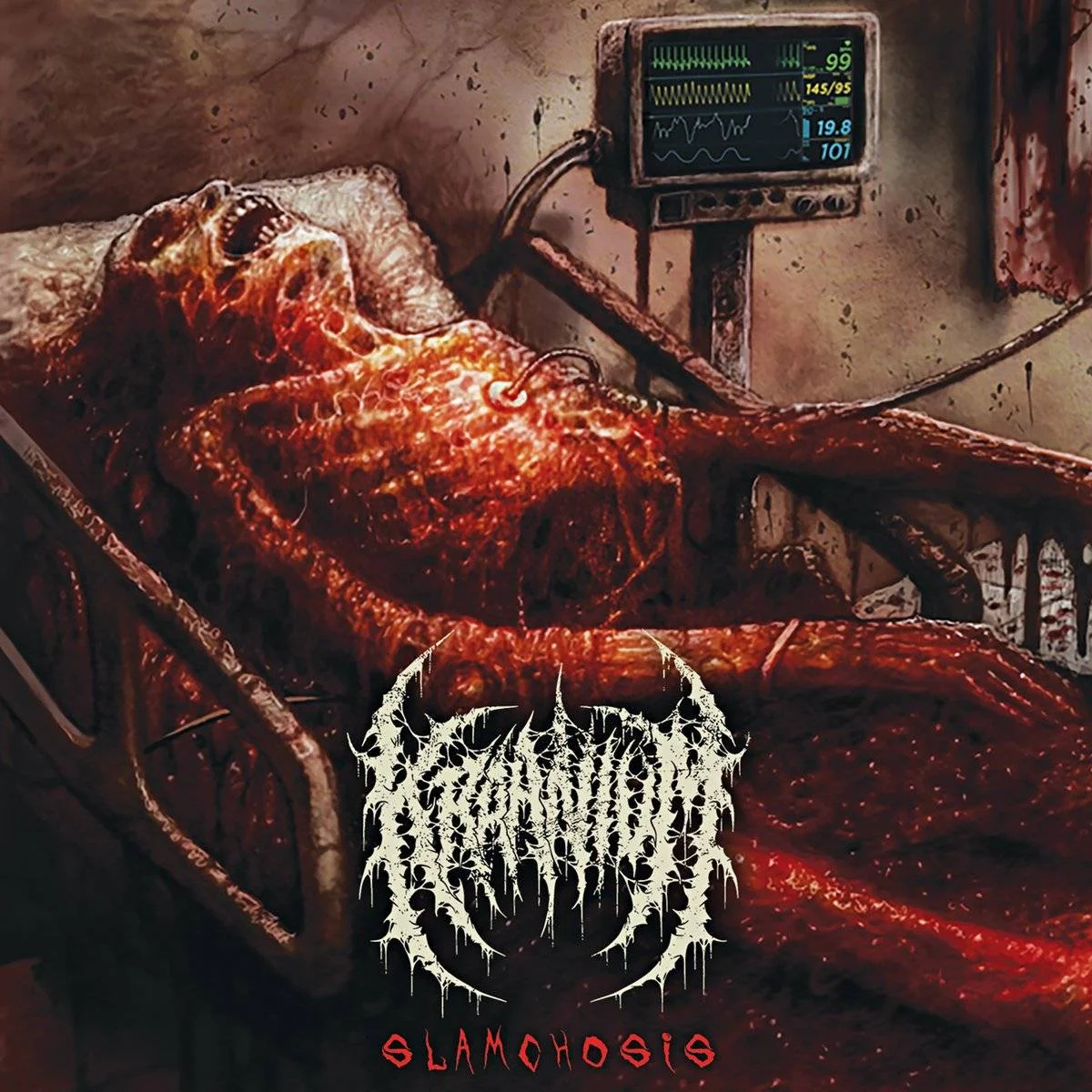 KRAANIUM - [ 2018 ] - Slamchosis - [ FLAC 16-Bit 44.1 kHz ] ** Brutal Death/Slamming Brutal Death - Norway