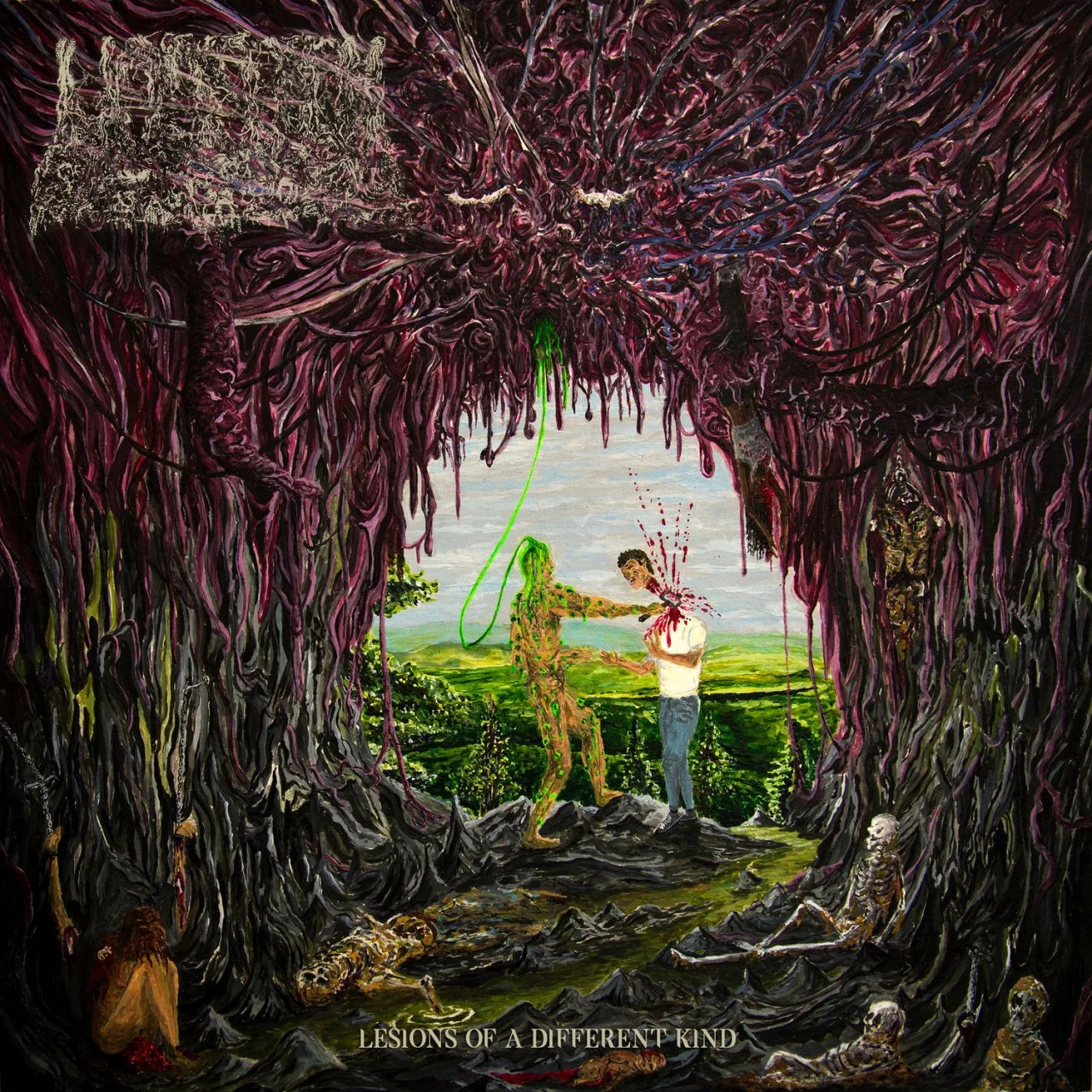 Hi-Res TR24 OF - UNDEATH - 2020 - Lesions Of A Different Kind - [ FLAC 24-Bit 44.1 kHz ]