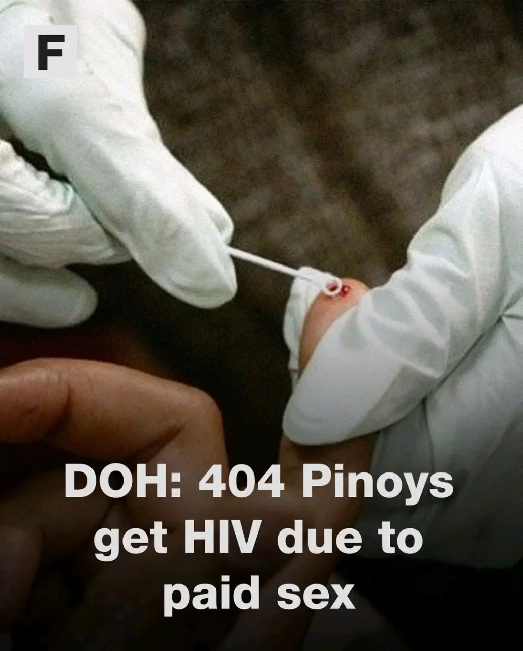 DOH: 404 Pinoys Get HIV Due To ρáíd ***