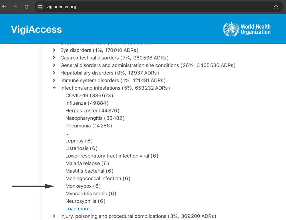 tedros-adhanom-ghebreyesus-who-monkeypox-side-effect-vaccine-2.webp