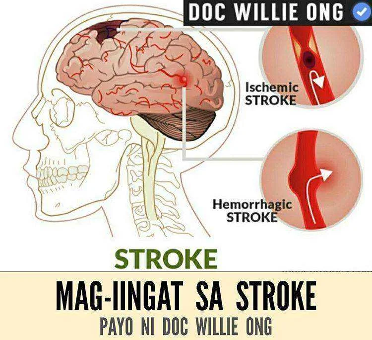docwillieong-20191029-0001.webp