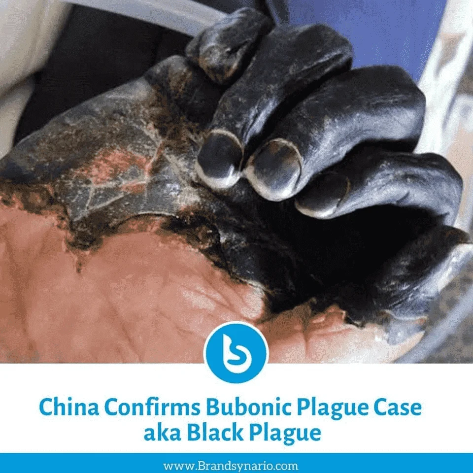 China Confirms Bubonic Plague Case a.k.a Black Plague