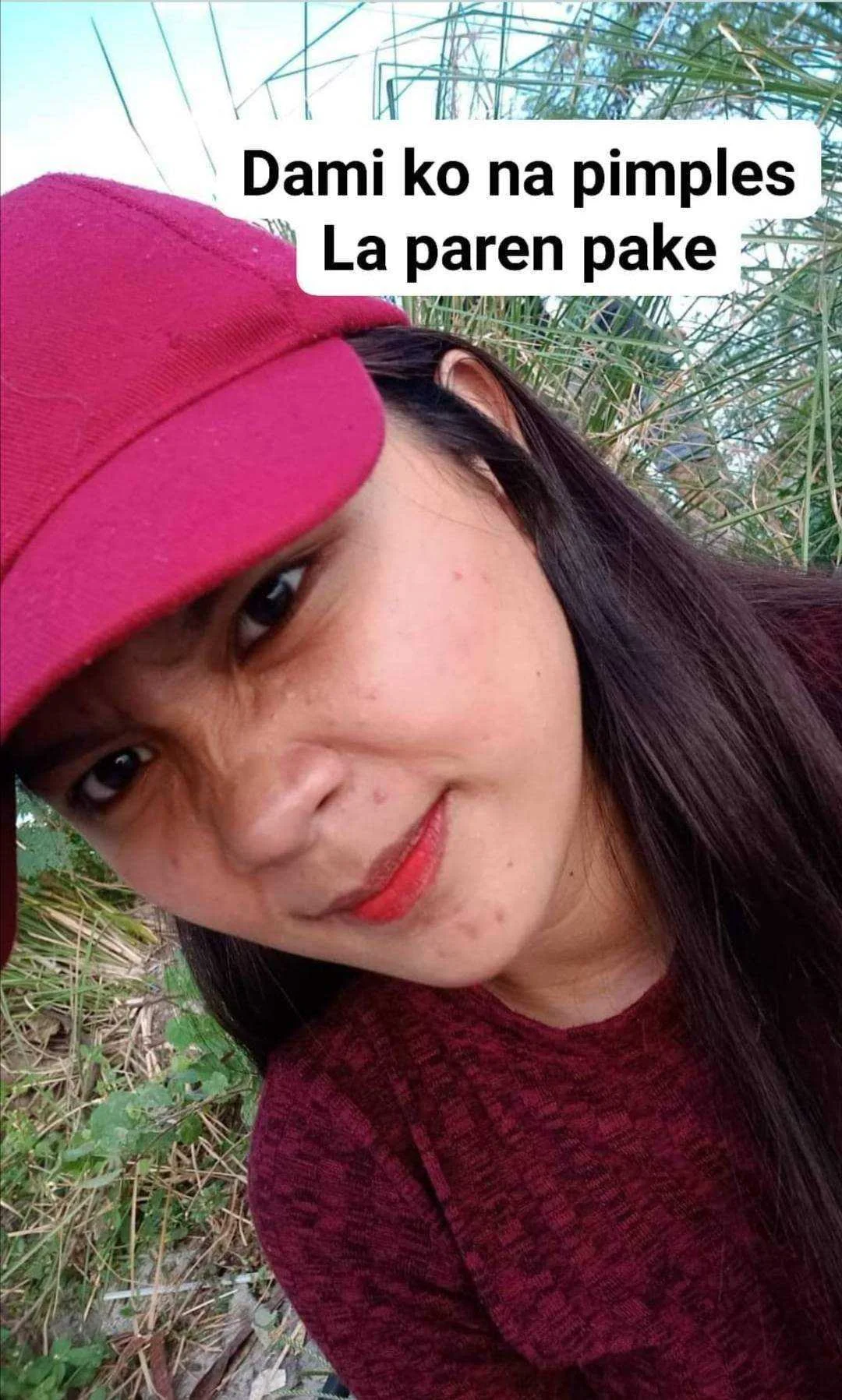 Pimples.png